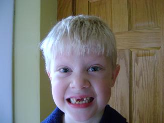 eliastooth2sm.JPG