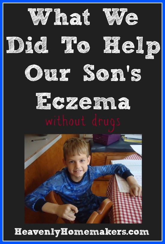 What We Did To Help Our Son's Eczema - Without Drugs